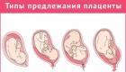 Коричневые выделения при беременности Небольшие выделения на 10 неделе беременности